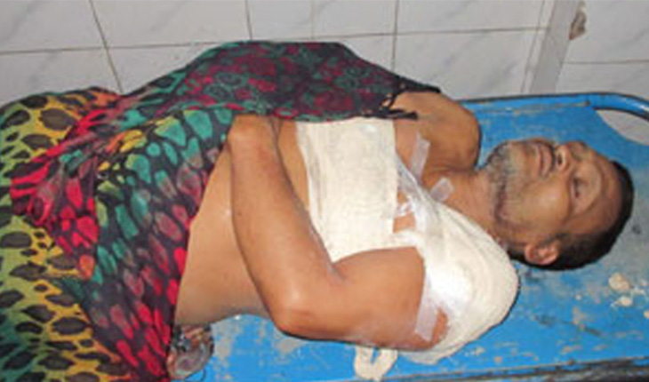 ঝিনাইদহে মুদী দোকানদারকে কুপিয়েছে দুর্বৃত্তরা ঝিনাইদহে মুদী দোকানদারকে কুপিয়েছে দুর্বৃ