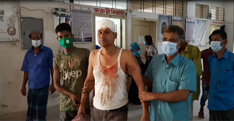 শ্রমিক ঠিকাদারের দরপত্র নিয়ে সংঘর্ষ,আহত