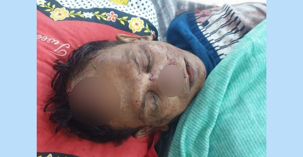 টাঙ্গাইলে সন্ত্রাসী হামলায় ডিস ব্যবসায়ি গুরুত্বর আহত টাঙ্গাইলে সন্ত্রাসী হামলায় ডিস ব্যবসায়ি