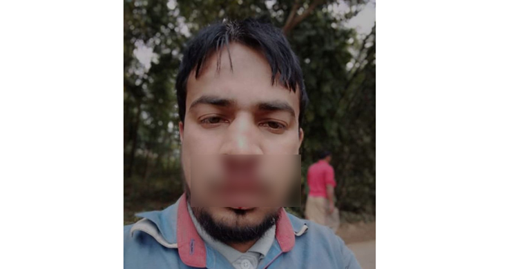 মাদক সেবনে বাধা দেওয়ায় নাক ভেঙে দিলো